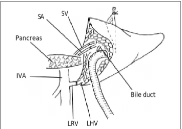Figure 1. Schematic review of the surgical technique for