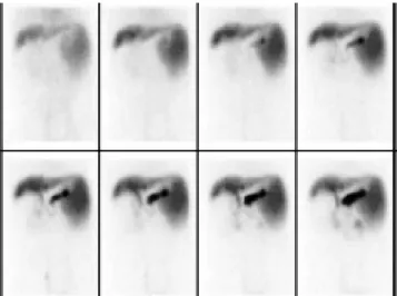 Figure 3. Liver function observed by nuclear medicine.