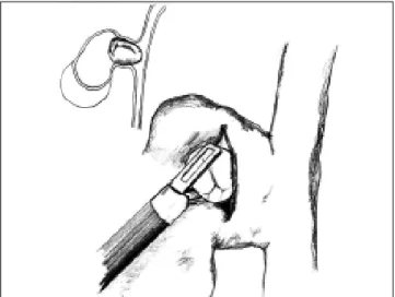 Figure 3. Intraoperative view.