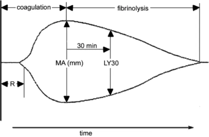 Figure 1. A representative labelled thromboelastograph (TEG) trace. The reaction time (R) is the time taken for a clot to begin forming and is established when the trace amplitude reaches 2 mm