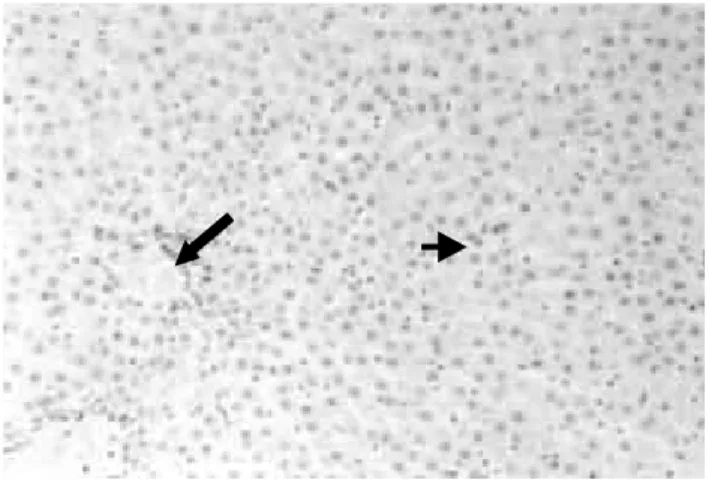 Figure 4. Light micrograph from a control rat liver. Large arrow shows