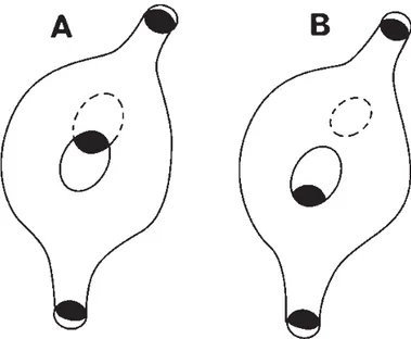 Fig. 8. Esquemas que muestran dos defectos septales dentro del orificio oval. A) tipo foramen secundum, B) tipo orificio oval.