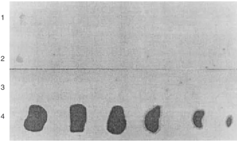 Fig. 3. Autorradiografía de la captación de talio201 en corazones controles