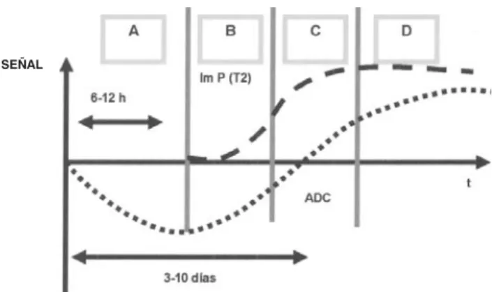 Figura 5. Esquema que representa la evolución de los valores de ADC