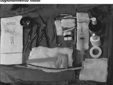 Figura 2. Material indispensable para colocar  taponamiento nasal