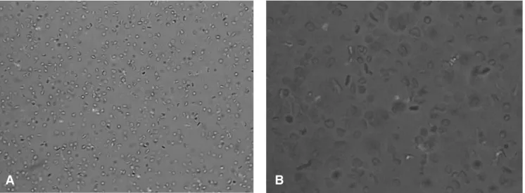 Figura 2. Muestras de eritrocitos reconstituidos recién preparadas, observadas al microscopio por el método de la &#34;gota fresca&#34;.