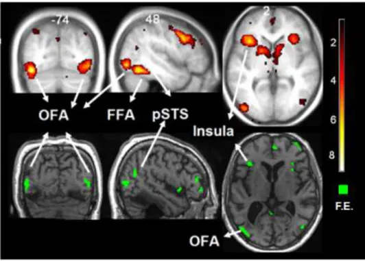 Figura  4.  Activación  neural  (RMNf)  para  caras  no  familiares.  Se  presentan  los  resultados  del 