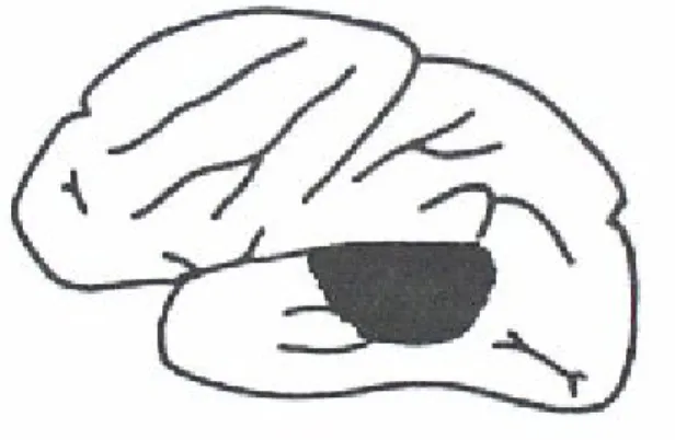 Figura 5.3. Área de la afasia de Wernicke