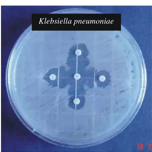 Figura 1.- Cepa de Klebsiella pneumoniae positiva a la producción de  β LEE por el método de Jarlier.