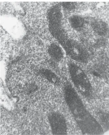 Figura 5. Radiografía antero-posterior de tórax en la que se muestra 