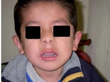 Figura 1. Facies del paciente.