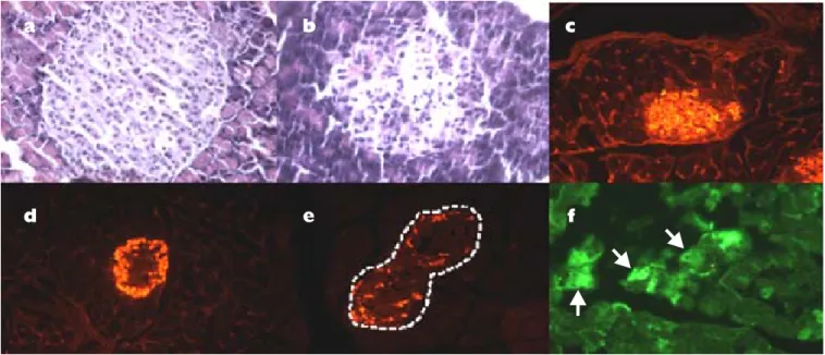 Figura 3.     Inducción de la expresión de células nestina positivas. La figura (a) muestra un islote de Langerhans con tamaño y celularidad conservada, H-E, 40X