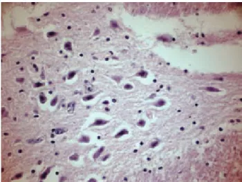 Figura 10. Neuronas con hipoxia (choque).