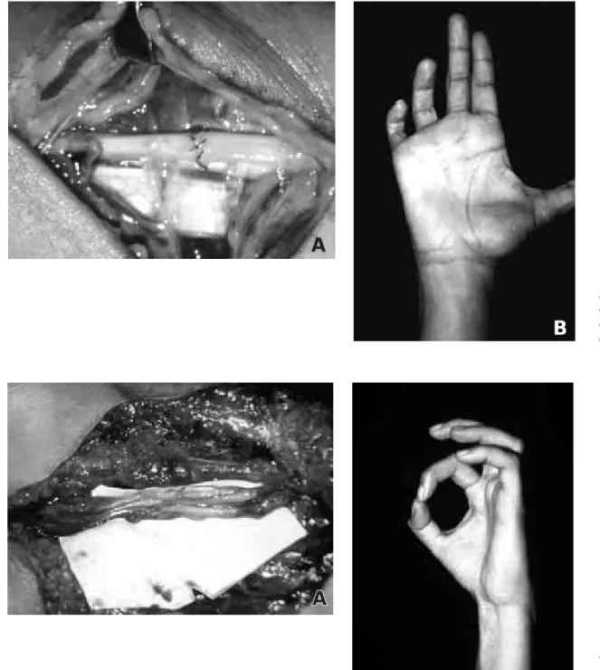 Figura 7. A) Reparación