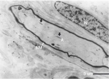 Figura 2. Micrografía electrónica de músculo estriado con