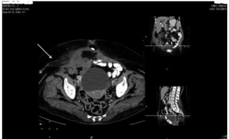figura 3. Tomografía computada en corte axial con medio de con-