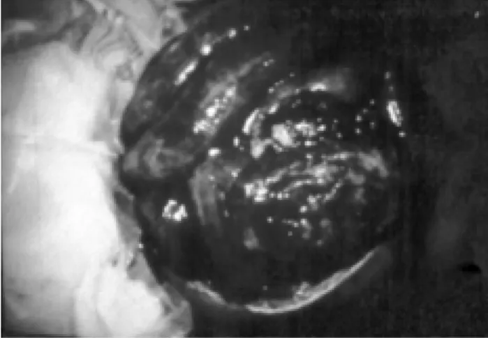Fig. 1. Herida abdominal con pérdida de tejido, evisceración.