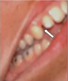 Fig. 3. Evolución satisfactoria postoperatoria 