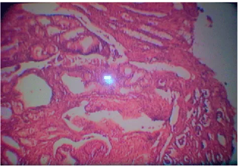 Fig. 3. Histología del adenoma 