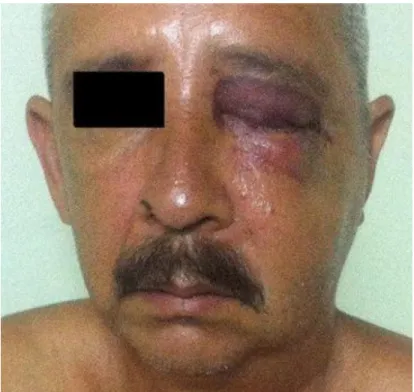 Fig 1. Paciente cuando llegó a consulta 