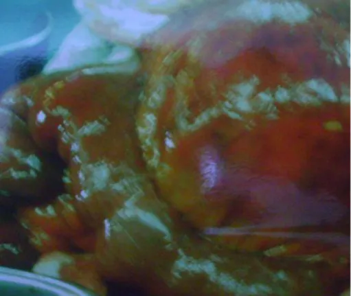 Fig. 4. Hallazgo transoperatorio: tumor de aspecto quístico en  