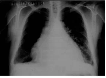 Fig. 2. Radiografía de torax.  