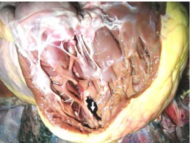 Figure 2. Anatomical specimen of the heart. The arrow is at 