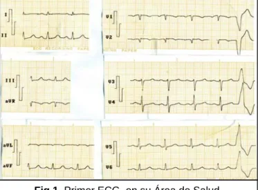 Fig 1. Primer ECG, en su Área de Salud.