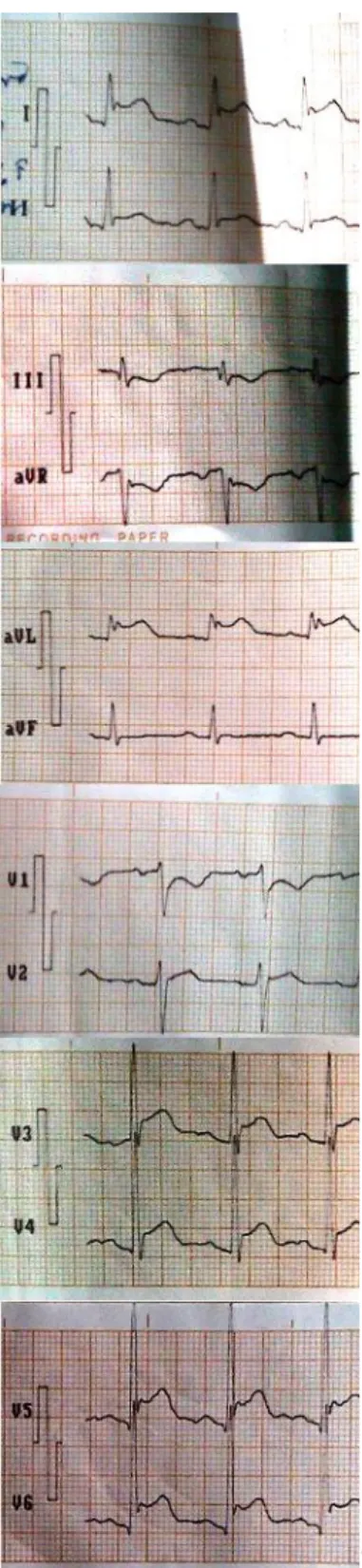 Figure 2. A 12-lead electrocardiogram 