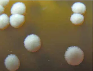 Figura 1. M. globosa, aspecto microscópico.