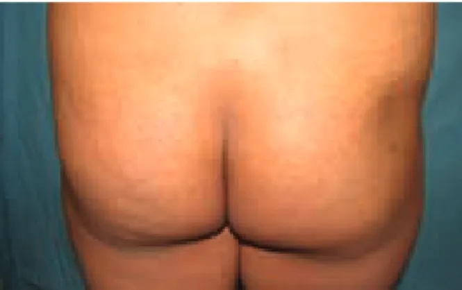Cuadro clínico