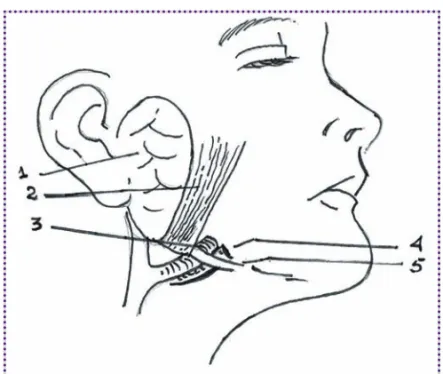 Figura 2. La ruta del nervio temporal: las líneas son lóbulo de la oreja-ceja, tragus-la arruga más alta.