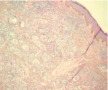 Figura 5 . Cuerpo asteroide.