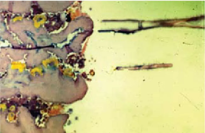 Figura 6 . Aspecto microfotográfico del extremo nutricio de la larva  de Dermatobia	hominis, donde aún hay restos alimenticios; puede  observarse uno de los ganchos nutricios