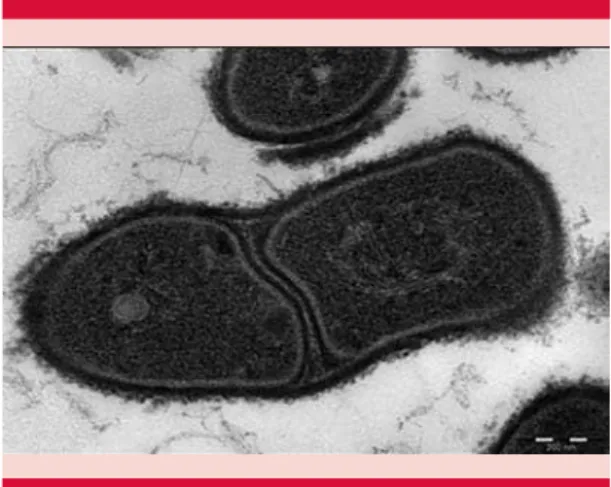 Figura 6. Cutibacterium acnes. Figure 6. Cutibacterium acnes.