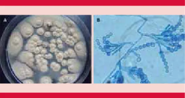 Figura 1.   Scopulariopsis sp.  A.  Morfología macros- macros-cópica: colonia subcultivada en agar papa dextrosa