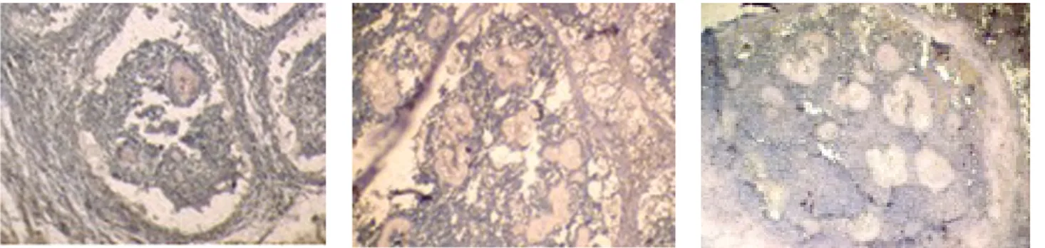 Figura 1. INF- γ, IL-4 e IL-10 en actinomicetoma inducido en ratón Balb/c por Nocardia	brasiliensis