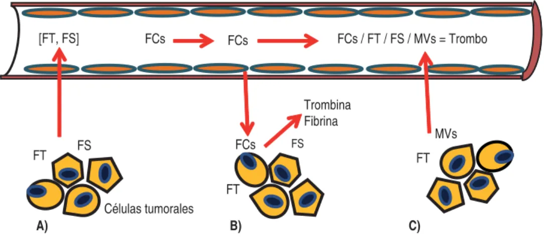 Figura 1. A) Incremento de la permeabilidad vascular, por acción de TS y FS. B) Extravasación de factores de la coagulación, y 