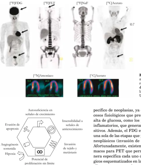 Figura 2. Etapas comunes en procesos neoplásicos  (Adaptada de [5]).