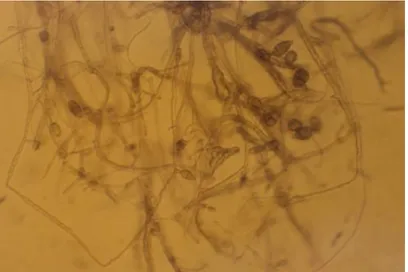 Figura 8. Microscopia del crecimiento micelial y conidios de A. alternata a los 12 d de 