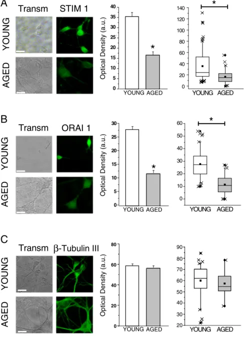 Fig. 2. In vitro aging is associated to decreased expression of Stim1 and Orai1. Short-term and long-term cultures of hippocampal neurons were ﬁxed and expression of Stim1 and Orai1 was tested by immunoﬂuorescence