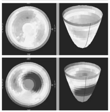 Figura 8. Estudio de metabolismo de la glucosa en corazón de rata