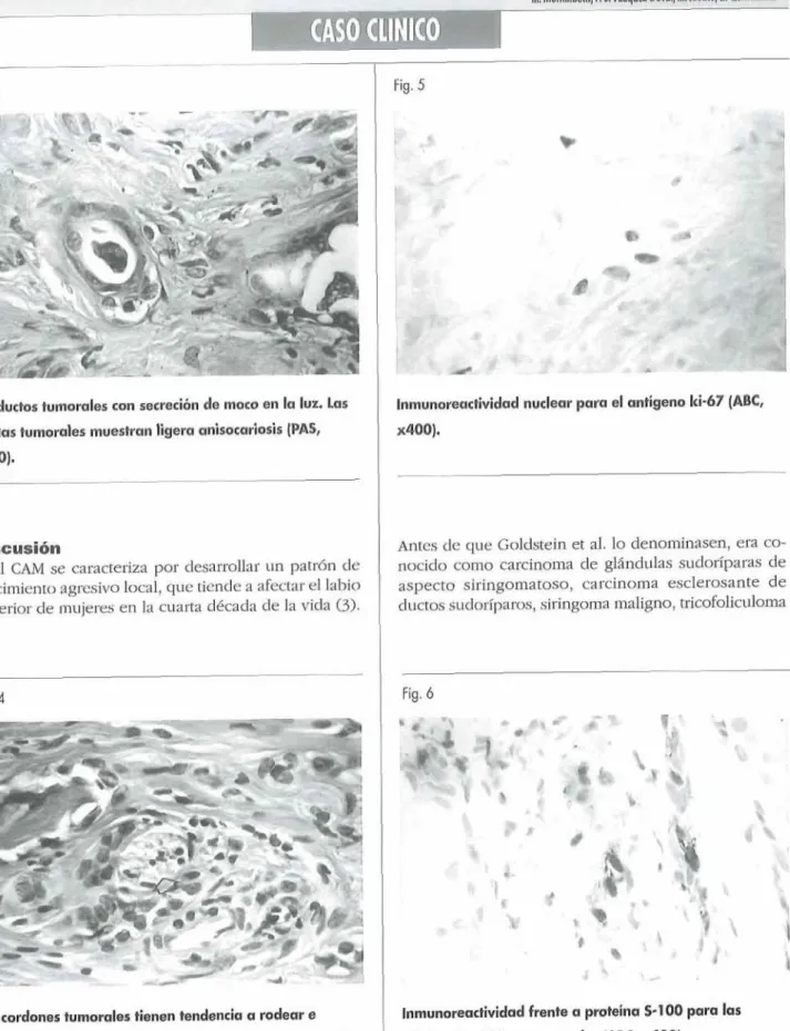 Fig.  il  Fig. 6 