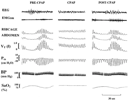 Figure 2. Effects of continuous positive