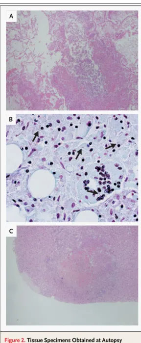 Figure 2. Tissue Specimens Obtained at Autopsy  from the Patient.