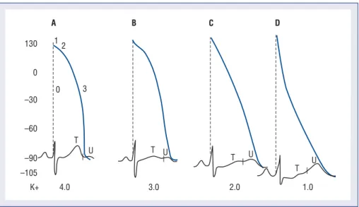 Figure 1. Diagram of the ventricular action potential superimposed on the ECG at different extracellular potassium concen- concen-trations (4.0, 3.0, 2.0 mEq/L)
