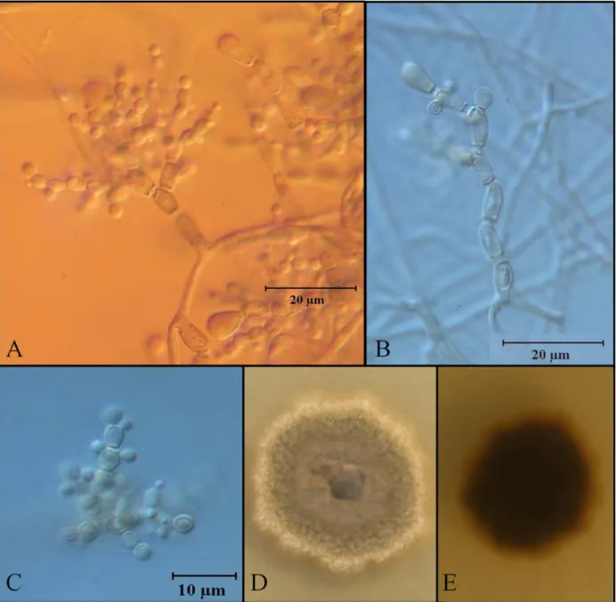 Figure 5.8  Nomarski microscopy of M84 showing polyblastic conidiophores (A), pyryform  cells of the conidiophores with broad septa (B), and blastoconidia in acropetal arrangement (C)