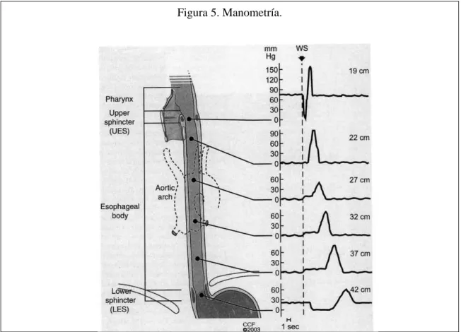 Figura 5. Manometría. 