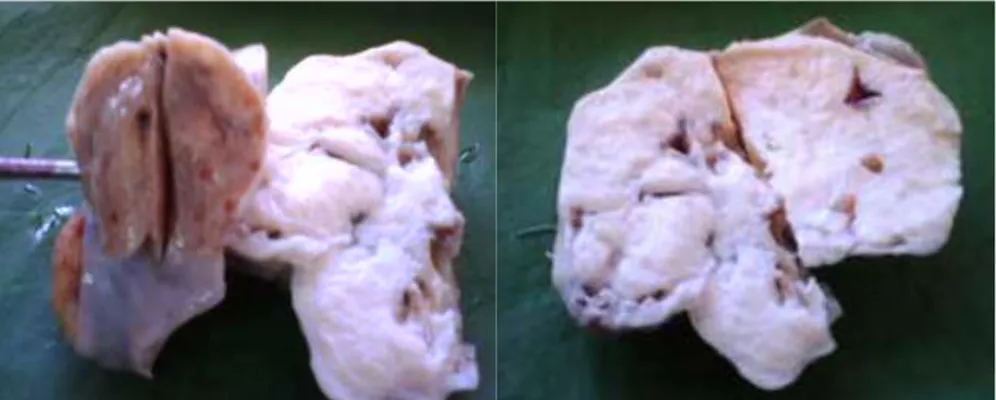Fig 2.  Corte tisular: A) tumor sólido de color gris blanquecino, 