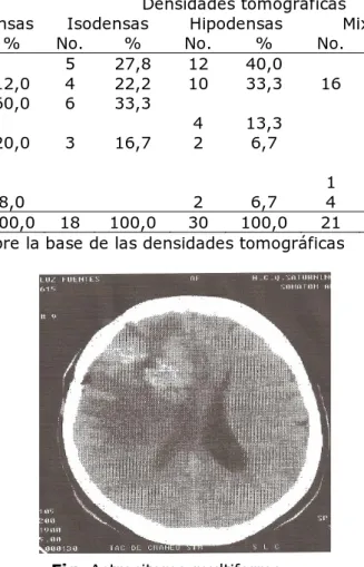 Tabla 1. Lesiones tomográfícas según densidades tomográficas  Densidades tomográficas 